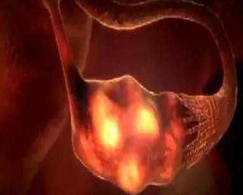 广州试管助孕流程时长解析与泰国第三代技术对比