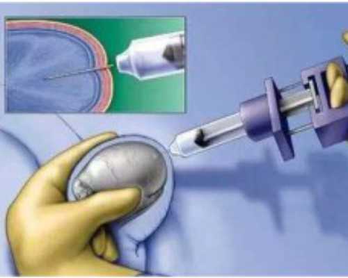 2025年广西供卵试管机构名单发布及生殖中心全面解析