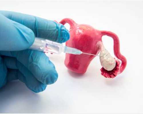 借卵试管利弊解析_做试管借卵子,珠海供卵试管技术解析