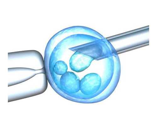 广西卵巢早衰供卵试管成功率解析与代生代怀选择指南