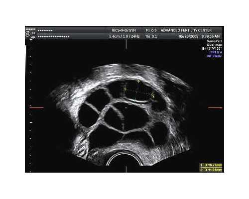 环球宝贝爱德华兹国际助孕|石家庄三代试管助孕费用解析